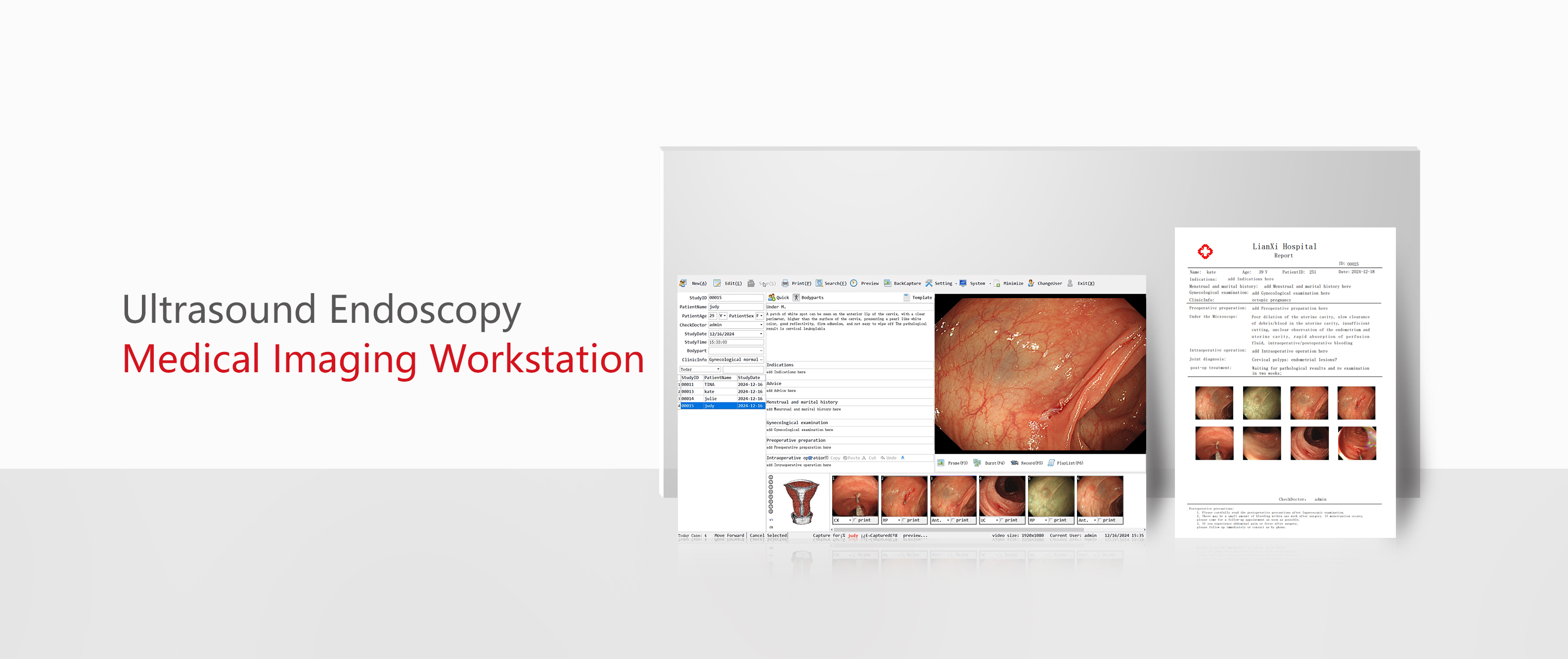 Ultrasound Endoscopy  Medical Imaging Workstation